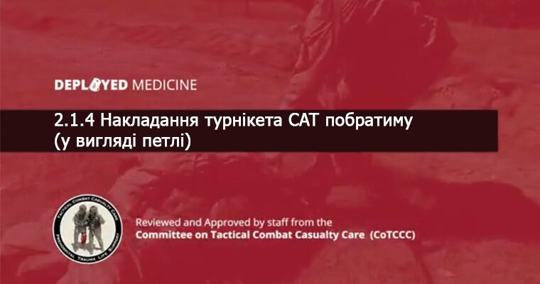 2.1.4 Накладання турнікета CAT побратиму (у вигляді петлі)