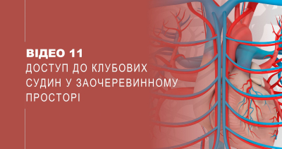 Відео 11. Доступ до клубових судин у заочеревинному просторі