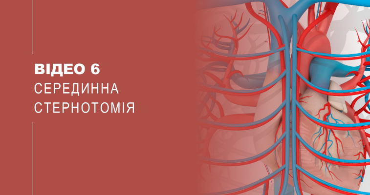 Відео 6. Серединна стернотомія