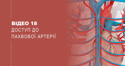 Відео 18. Доступ до пахвової артерії