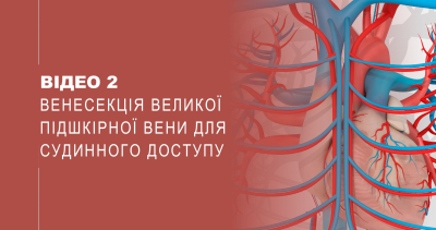 Відео 2. Венесекція великої підшкірної вени для судинного доступу