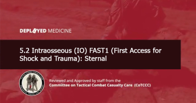 5.2 Intraosseous (IO) FAST1 (First Access for Shock and Trauma): Sternal