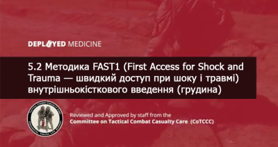 5.2 Методика FAST1 (First Access for Shock and Trauma — швидкий доступ при шоку і травмі) внутрішньокісткового введення (грудина)