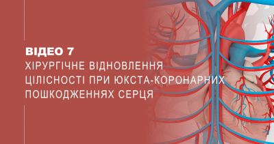 Відео 7. Хірургічне відновлення цілісності при юкста-коронарних пошкодженнях серця