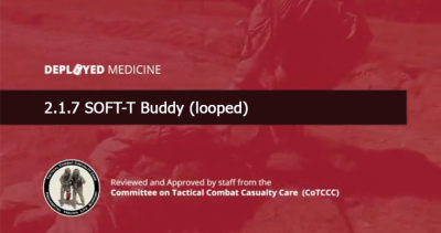 2.1.7 SOFT-T Buddy (looped)