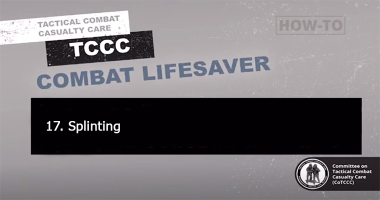17. Splinting