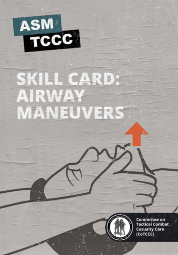 Skill Card: Airway Maneuvers