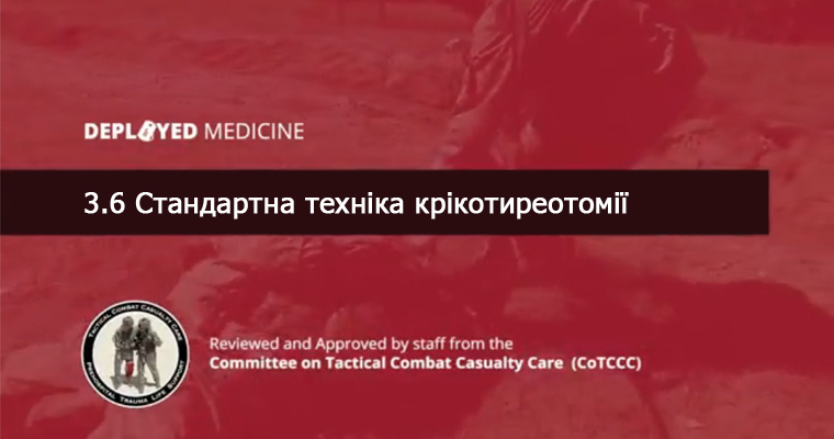 3.6 Стандартна техніка крікотиреотомії
