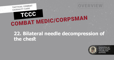 22. Bilateral needle decompression of the chest