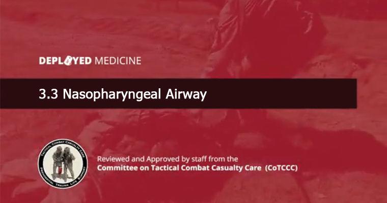 3.3 Nasopharyngeal Airway