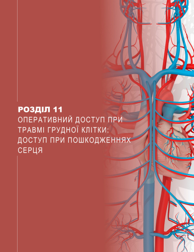 Розділ 11 Оперативний доступ при травмі грудної клітки: доступ при пошкодженнях серця