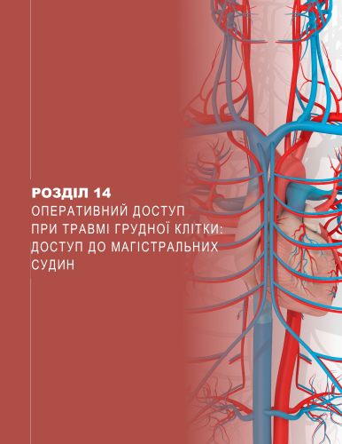 Розділ 14 Оперативний доступ при травмі грудної клітки: доступ до магістральних судин