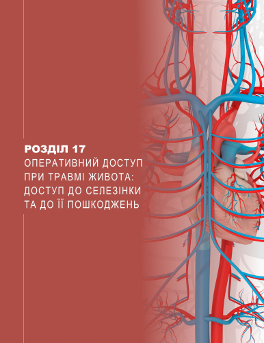 Розділ 17 Оперативний доступ при травмі живота: доступ до селезінки та до її пошкоджень