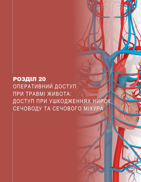 Розділ 20 Оперативний доступ при травмі живота: доступ при ушкодженнях нирок, сечоводу та сечового міхура Розділ 20 Оперативний доступ при травмі живота: доступ при ушкодженнях нирок, сечоводу та сечового міхура