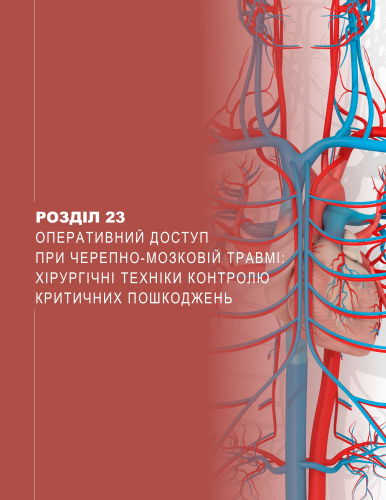 Розділ 23 Оперативний доступ при черепно-мозковій травмі: хірургічні техніки контролю критичних пошкоджень