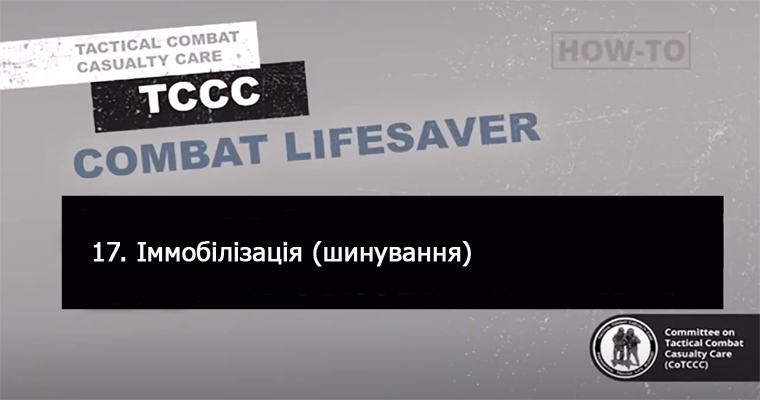 17. Іммобілізація (шинування)