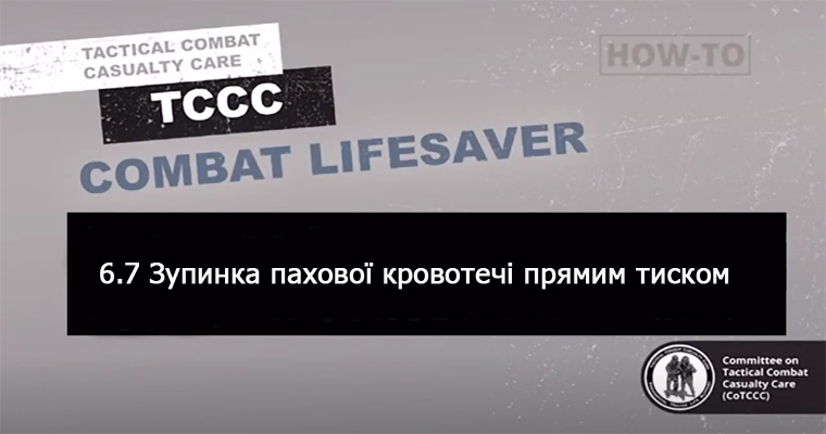 6.7 Зупинка вузлової пахової кровотечі за допомогою імпровізованого пристрою для створення тиску (ПСТ)