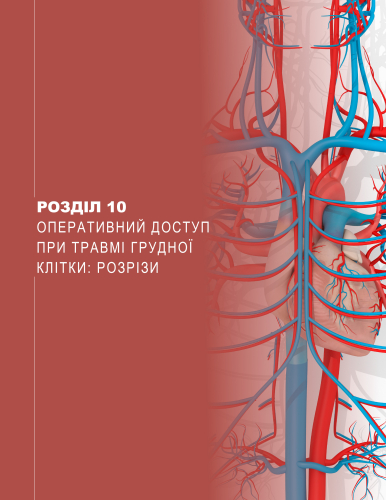 Розділ 10 Оперативний доступ при травмі грудної клітки: розрізи