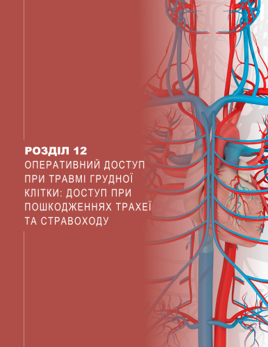 Розділ 12 Оперативний доступ при травмі грудної клітки: доступ при пошкодженнях трахеї та стравоходу