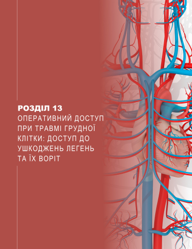 Розділ 13 Оперативний доступ при травмі грудної клітки: доступ до ушкоджень легень та їх воріт