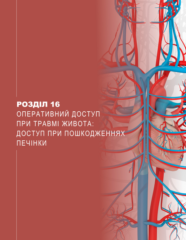 Розділ 16 Оперативний доступ при травмі живота: доступ при пошкодженнях печінки Розділ 16 Оперативний доступ при травмі живота: доступ при пошкодженнях печінки
