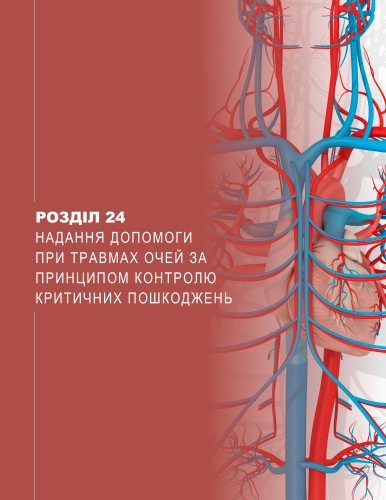 Розділ 24 Надання допомоги при травмах очей за принципом контролю критичних пошкоджень