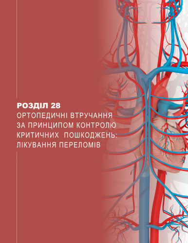 Розділ 28 Ортопедичні втручання за принципом контролю критичних пошкоджень: лікування переломів