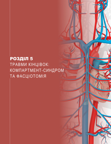 Розділ 5 Травми кінцівок: Компартмент-синдром та фасціотомія