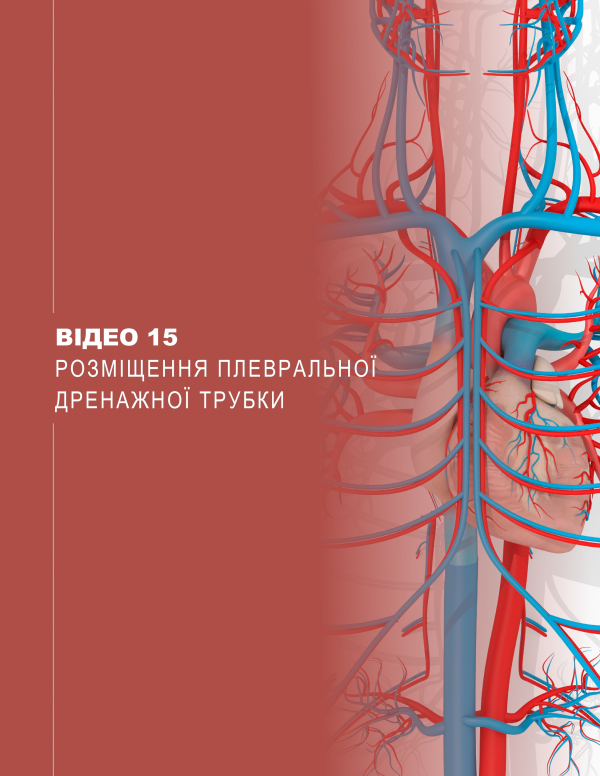 Video 15. Chest tube insertion Video 15. Chest tube insertion
