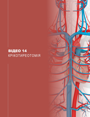Відео 14. Крікотиреотомія