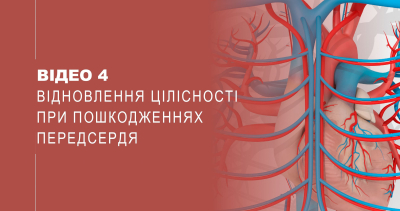 Відео 4. Відновлення цілісності при пошкодженнях передсердя