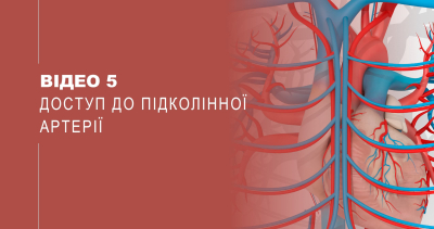 Відео 5. Доступ до підколінної артерії