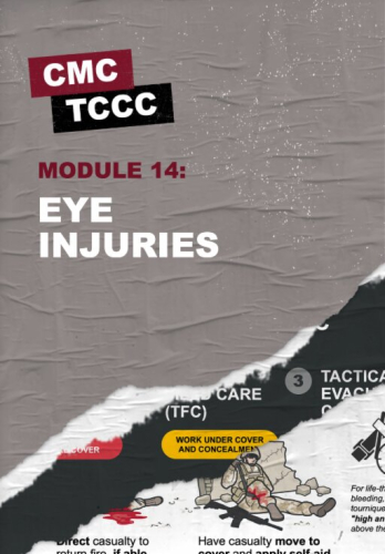 Module 14: Eye Injuries