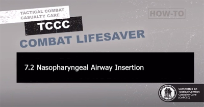 7.2 Nasopharyngeal Airway Insertion
