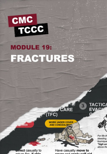 Module 19: Fractures