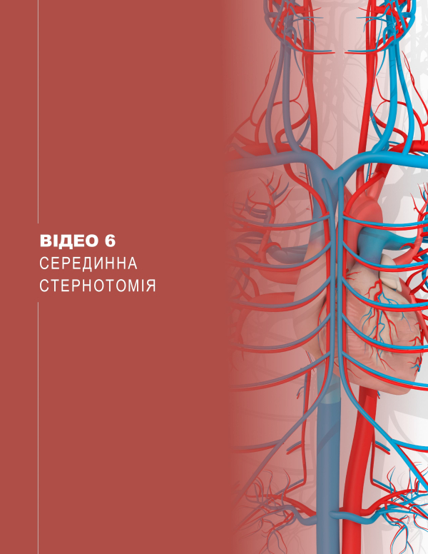 Video 6. Median Sternotomy Video 6. Median Sternotomy