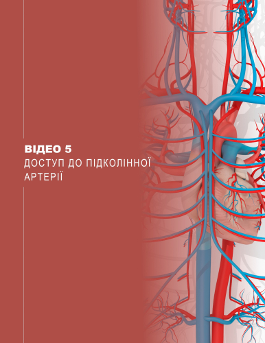 Відео 5. Доступ до підколінної артерії
