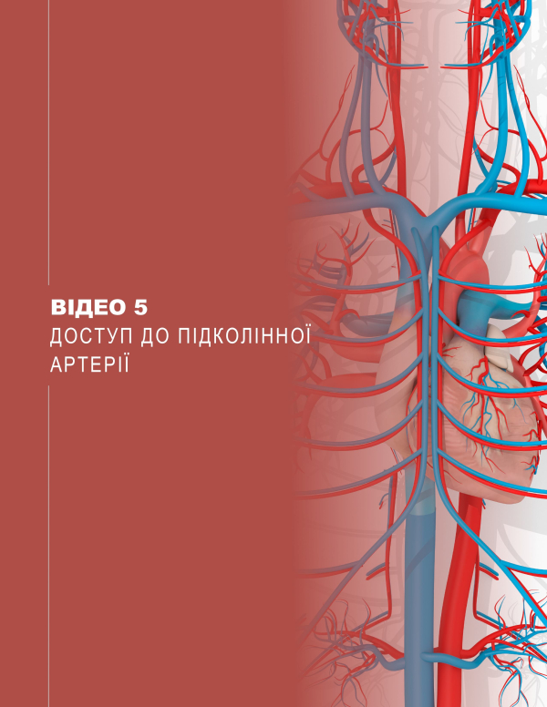 Video 5. Popliteal Exposure Video 5. Popliteal Exposure