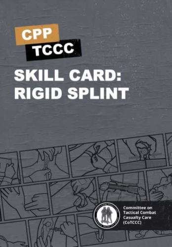 Skill Card 52: Rigid Splint Instruction