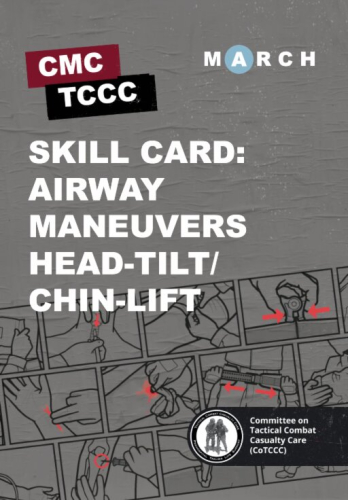 Skill Card 21: Airway Maneuvers: Head-Tilt/Chin-Lift