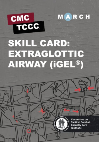 Skill Card 27: Extraglottic Aiway (igel)