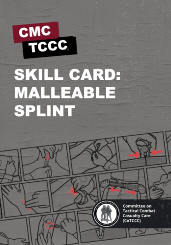 Skill Card 47: Malleable Splint