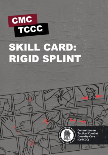 Skill Card 48: Rigid Splint 