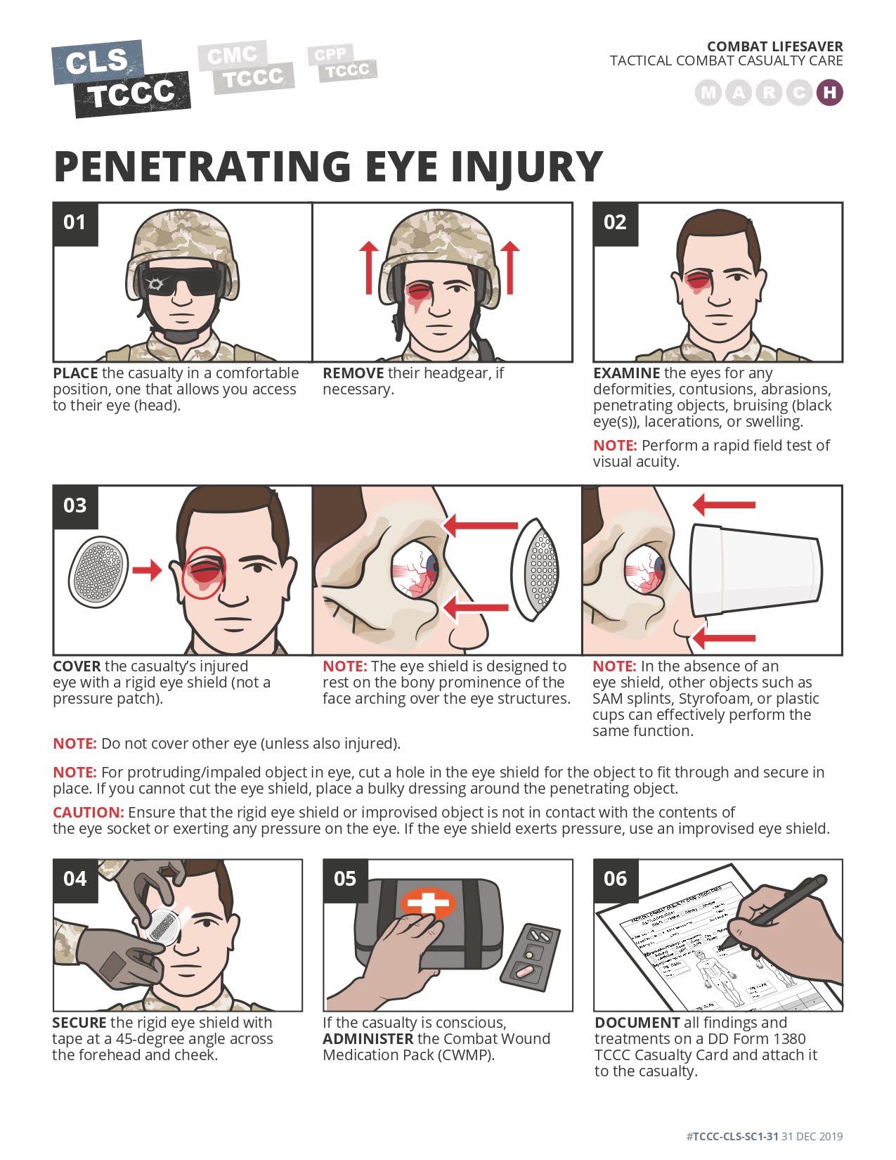Penetrating Eye Injury
