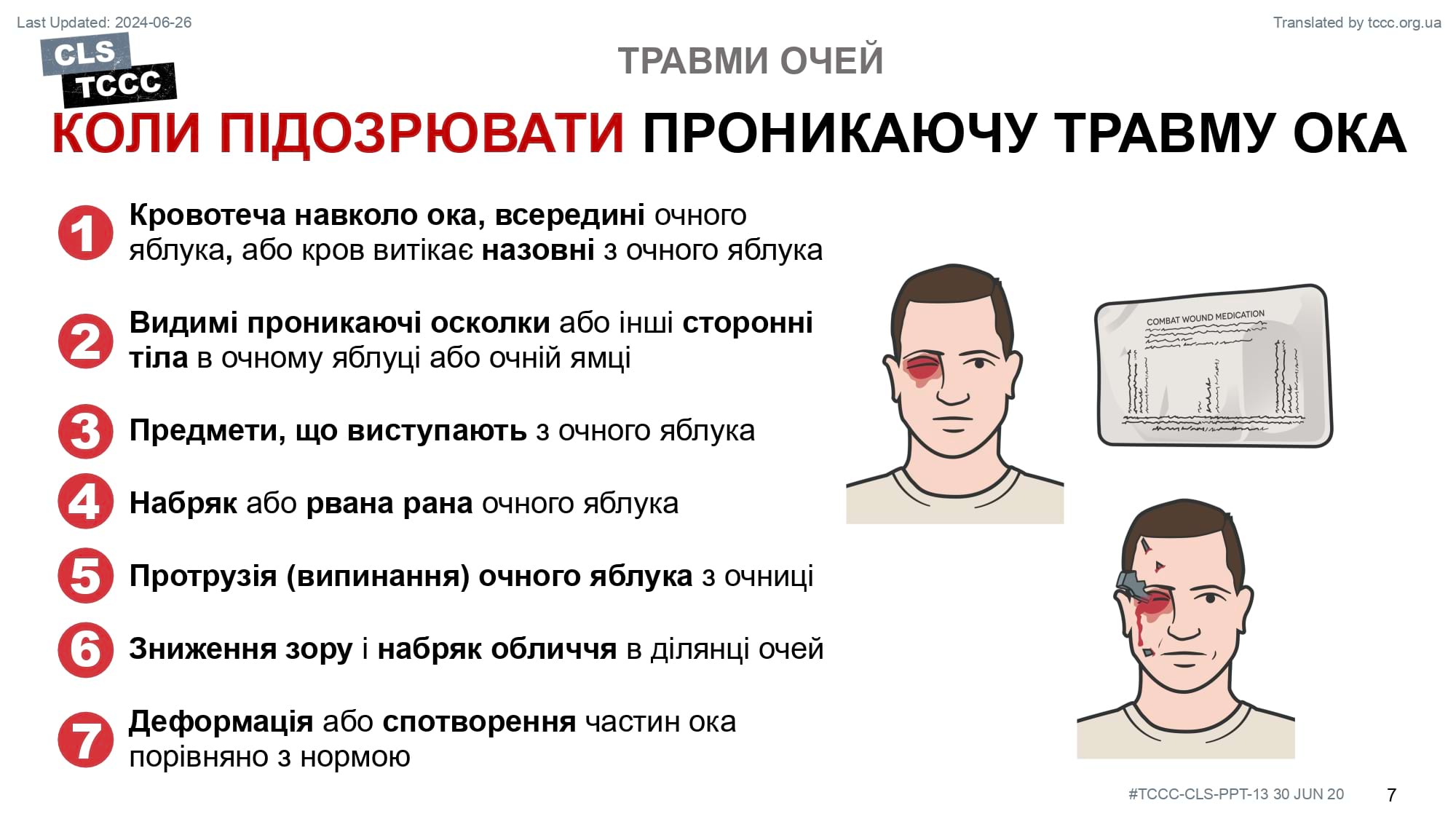 module-13-eye-injuries-slide-07
