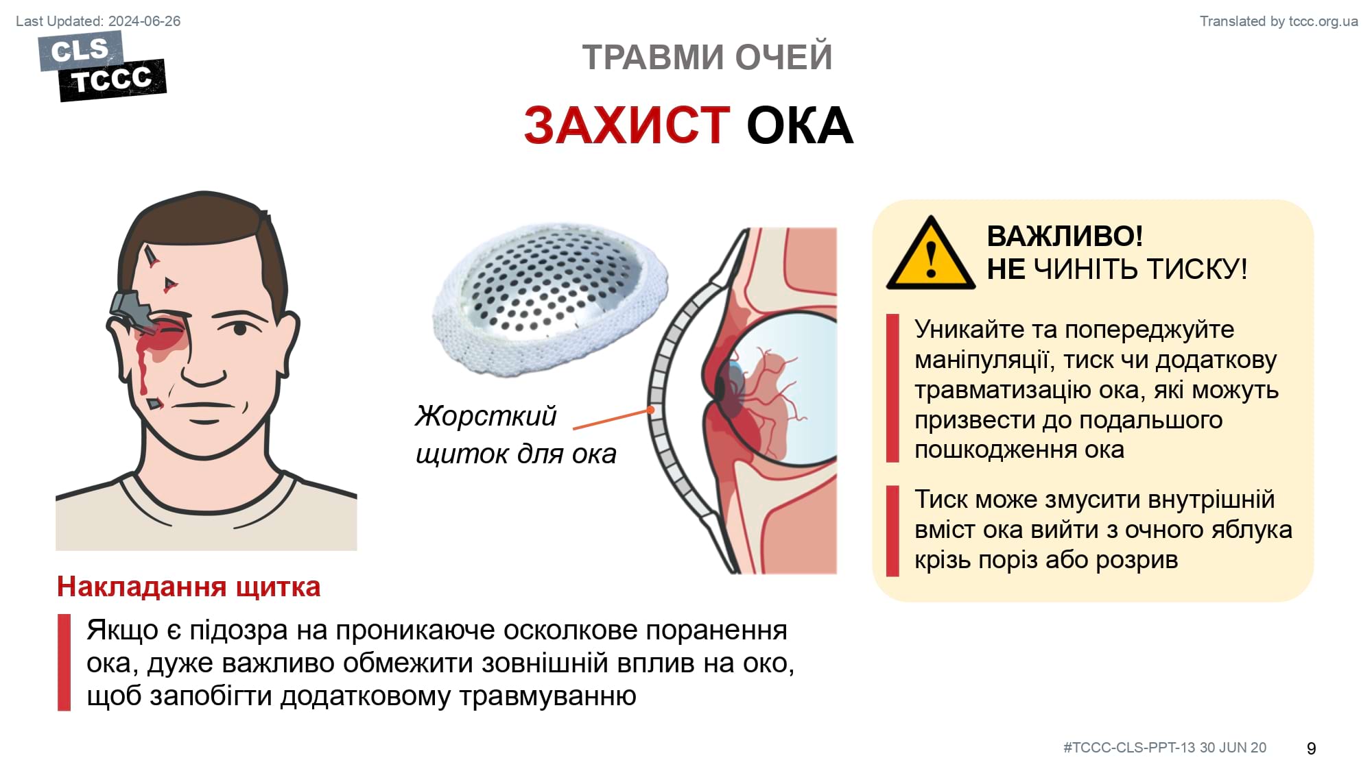 module-13-eye-injuries-slide-09