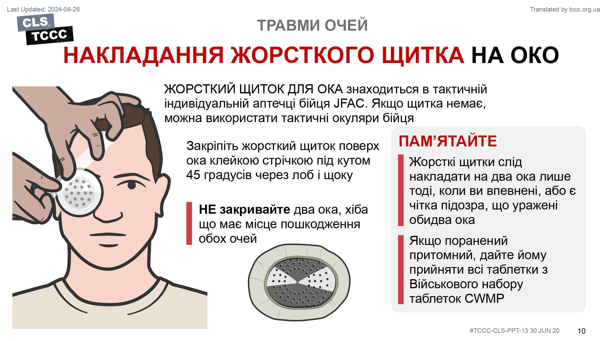 module-13-eye-injuries-slide-10