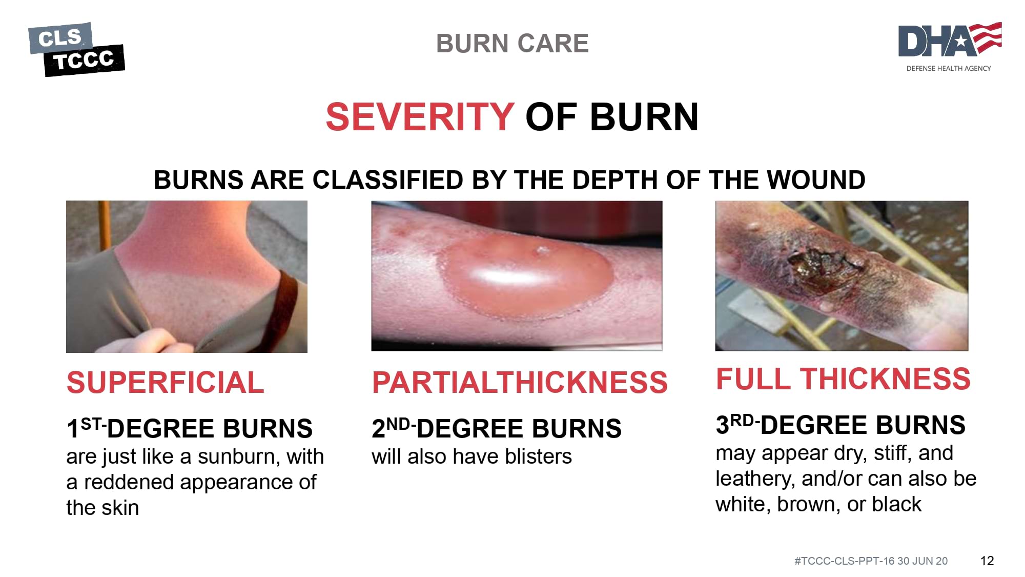 module-16-burns-slide-12