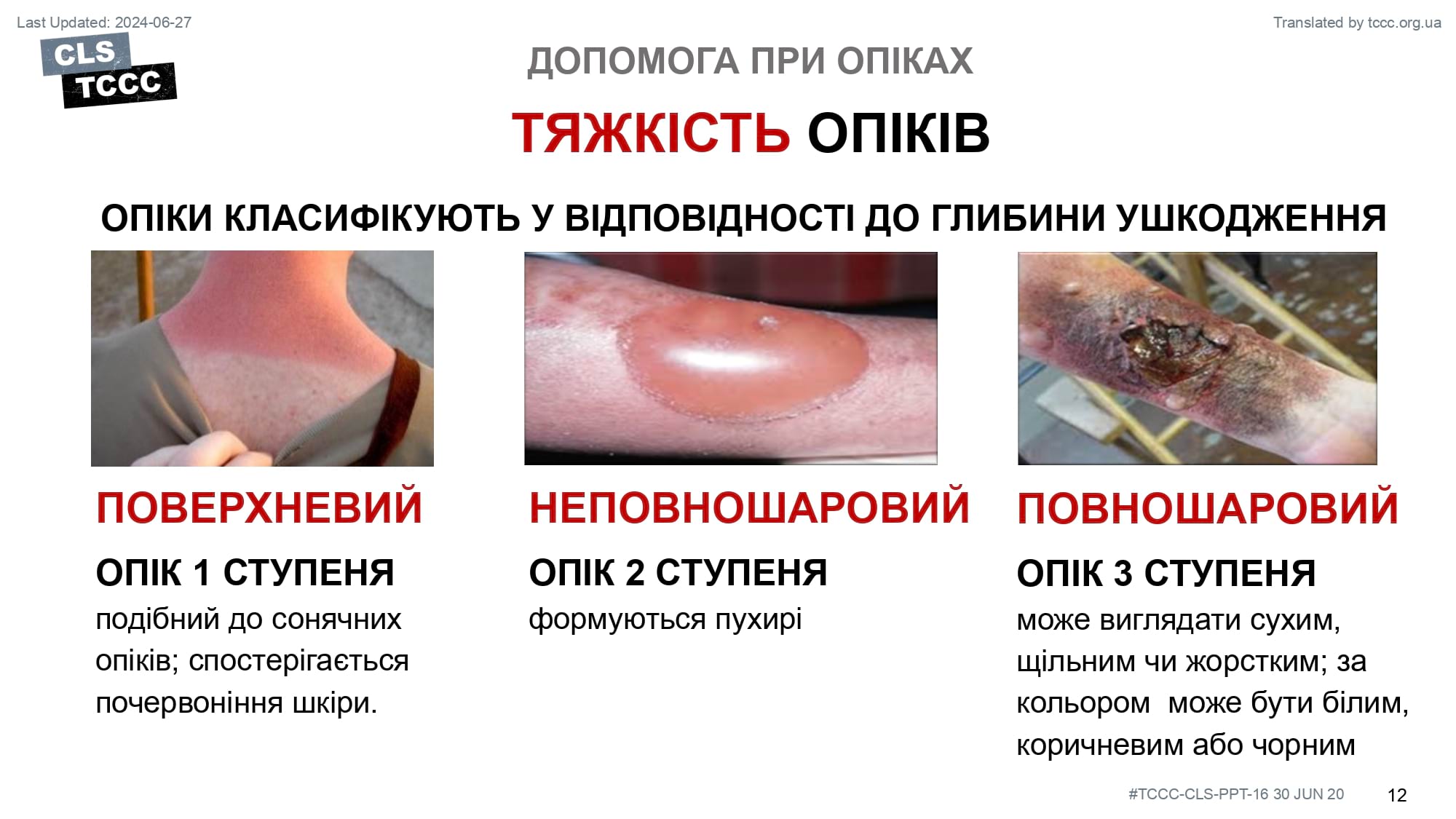 module-16-burns-slide-12