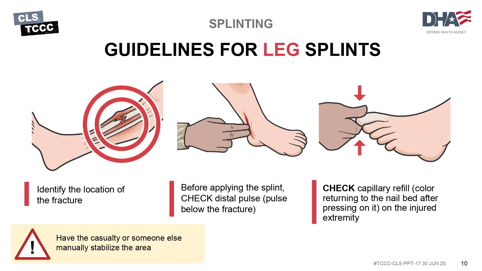module-17-fractures-splinting-slide-10
